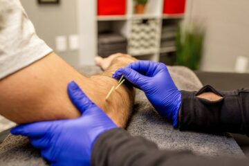 Dry Needling Therapy